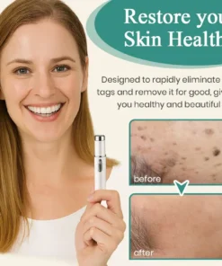 Bikenda® Mole and Wart Instant Removal Laser Pen