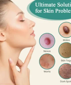 Bikenda® Mole and Wart Instant Removal Laser Pen