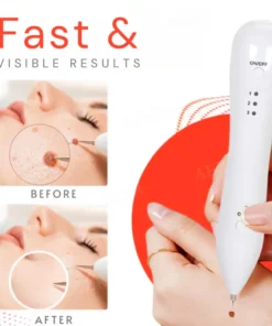 Bikenda® Portable Skin Care Laser Pen