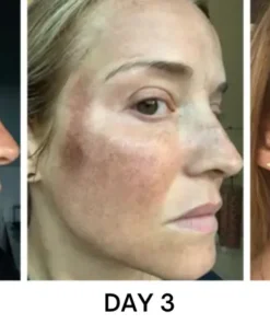 Bikenda® Portable Skin Care Laser Pen