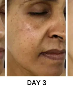 Bikenda® Portable Skin Care Laser Pen