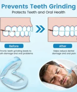 Bikenda® DreamGuard: Anti-Snoring & Teeth Grinding Teeth Protector