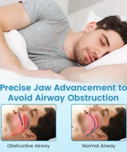 Bikenda® DreamGuard: Anti-Snoring & Teeth Grinding Teeth Protector