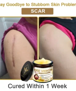 Rolimey® Bee Venom Skin Comprehensive Cream