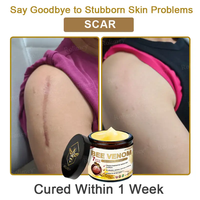 Rolimey® Bee Venom Skin Comprehensive Cream