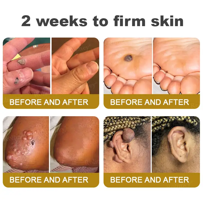 Rolimey® Bee Venom Skin Comprehensive Cream