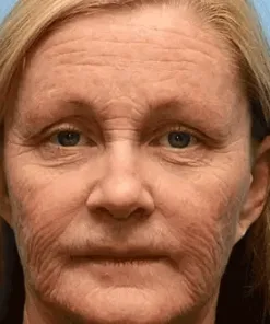 Rolimey® Bee Venom Skin Comprehensive Cream